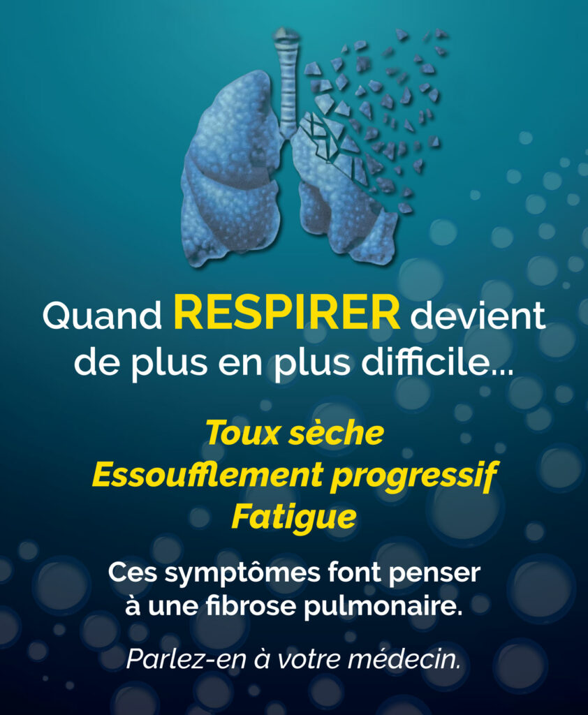 L’Association Belge Francophone contre la Fibrose Pulmonaire (ABFFP)